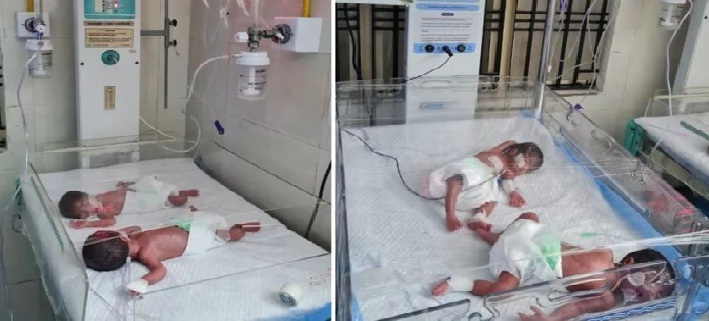UP : ऑटो चालक की पत्नी ने दिया चार बेटियों को जन्म