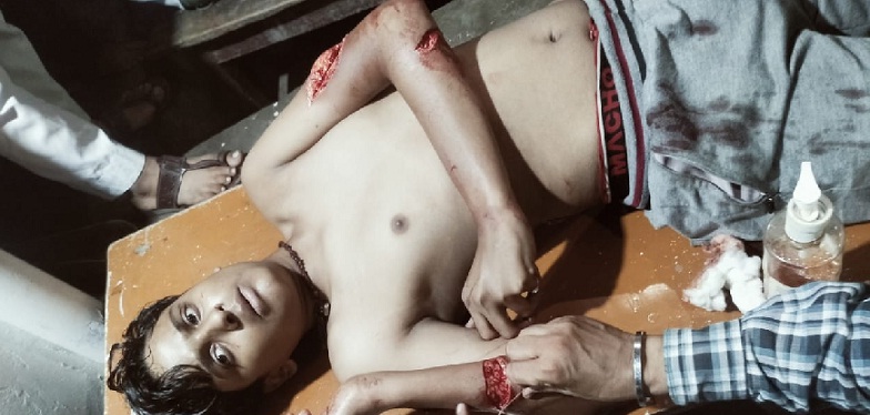 Gonda : इमरजेंसी के गेट पर प्रतीक्षा करते निकले प्राण!