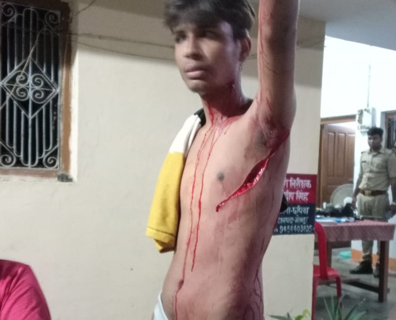 Gonda : इमरजेंसी के गेट पर प्रतीक्षा करते निकले प्राण!